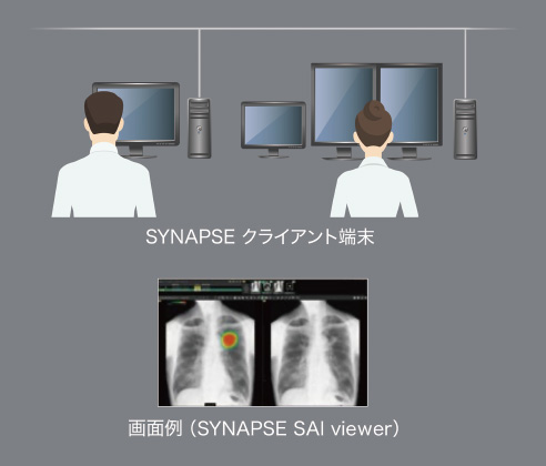 胸部X線プロセス